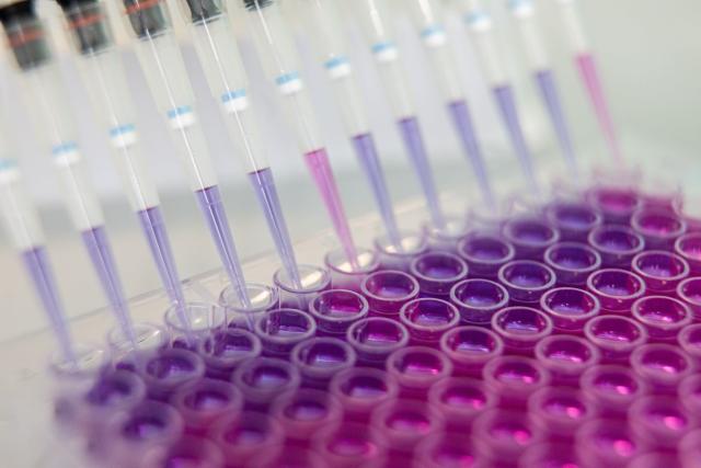 Frazier SPAC is in talks with NewAmsterdam Pharma to merge